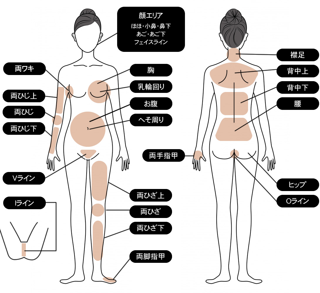 光美容器の使用箇所・顔・腕・脚・VIOなど