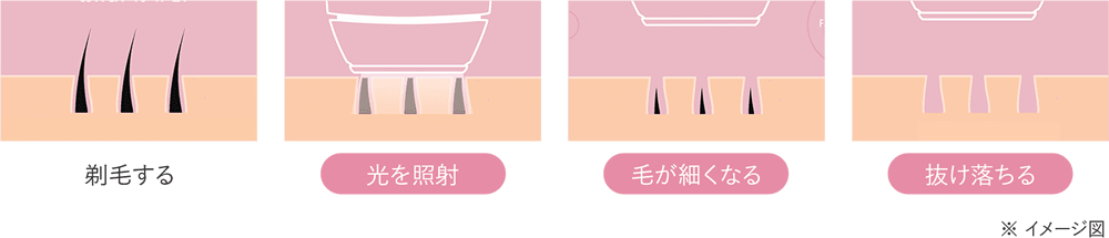 脱毛サロンでも採用されている技術搭載