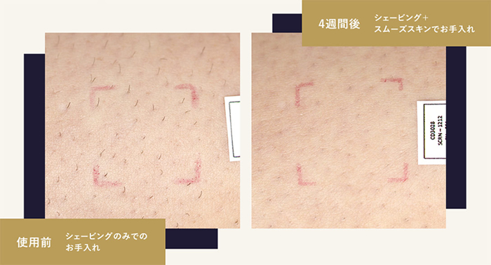スムーズスキン ピュアフィットの使用比較