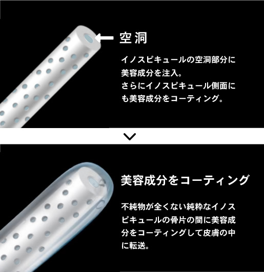 天然微細針【イノスピキュール】は99.8%シリカが主成分
