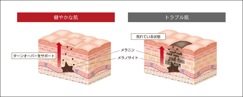 タンニンコンプレックス